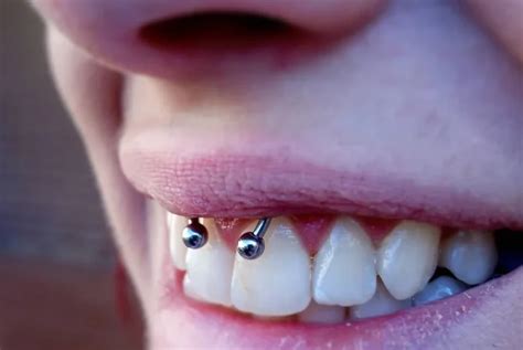 how long does a smiley piercing last|Smiley Piercing: Your Complete Guide